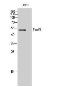 Western blot analysis of LOVO cells using Anti-FOXN4 Antibody