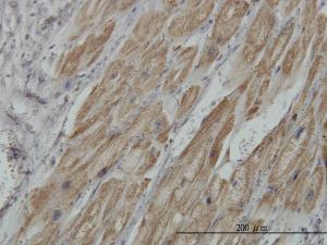 Anti-PDHB Mouse Monoclonal Antibody [clone: 2B2]