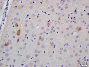 Anti-NFH Rabbit Polyclonal Antibody