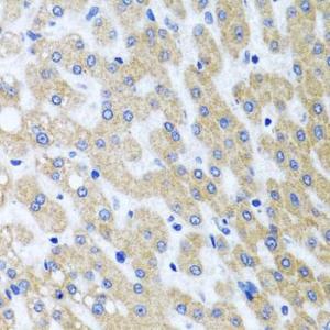 Immunohistochemistry analysis of paraffin-embedded human liver damage using Anti-PRMT2 / HMT1 Antibody (A11885) at a dilution of 1:100 (40x lens). Perform microwave antigen retrieval with 10 mM PBS buffer pH 7.2 before commencing with IHC staining protocol.