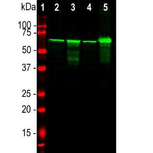 Western blot analysis of different tissue lysates using Anti-NF-L Antibody (1:20,000/green) [1] protein standard (red), [2] rat brain, [3] rat spinal cord, [4] mouse brain, [5] mouse spinal cord The strong band at 68kDa corresponds to the NF-L protein