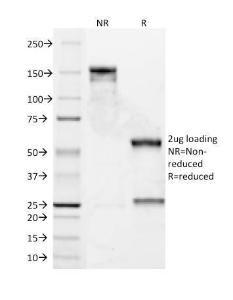 SDS-PAGE analysis of Anti-Bcl-2 Antibody [8C8] under non-reduced and reduced conditions; showing intact IgG and intact heavy and light chains, respectively. SDS-PAGE analysis confirms the integrity and purity of the antibody