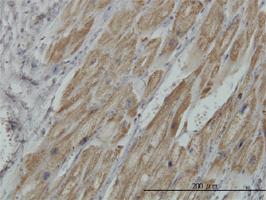 Anti-PDHB Mouse Monoclonal Antibody [clone: 2B2]