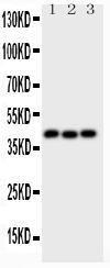 Anti-Wnt5a Polyclonal Antibody