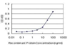 Anti-PDHB Mouse Monoclonal Antibody [clone: 2B2]