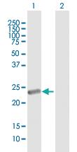 Anti-METTL15 Mouse Polyclonal Antibody