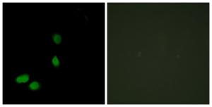 Antibody anti-HMG17 A95862-100 100 µg