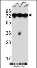 Anti-HSPA5 Rabbit Polyclonal Antibody