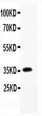 Anti-CCL4/MIP-1 beta Polyclonal Antibody