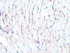 Anti-Dystrophin Rabbit Monoclonal Antibody [clone: ARC1118]