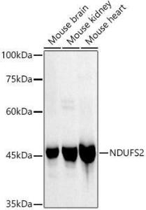 Anti-NDUFS2 Rabbit Monoclonal Antibody [clone: ARC3018]