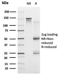 SDS-PAGE analysis of Anti-PRMT7 Antibody [PCRP-PRMT7-1A4] under non-reduced and reduced conditions; showing intact IgG and intact heavy and light chains, respectively. SDS-PAGE analysis confirms the integrity and purity of the antibody