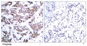 Anti-MEF2A Rabbit Polyclonal Antibody