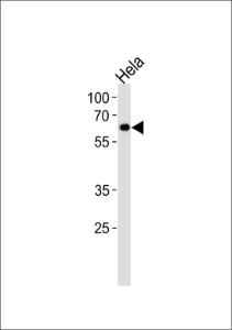 Anti-NR1D2 Rabbit Polyclonal Antibody (HRP (Horseradish Peroxidase))