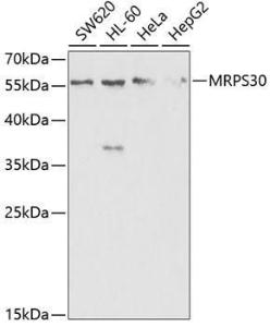 Western blot analysis of extracts of various cell lines, using Anti-MRPS30 Antibody (A11887) at 1:1000 dilution