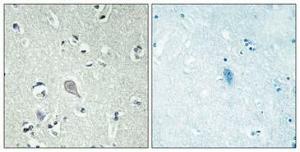 Antibody anti-CRHR1 A96076-100 100 µg