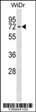 Anti-CTNNBL1 Rabbit Polyclonal Antibody