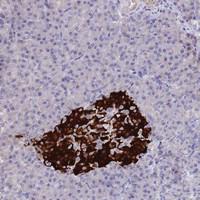 Anti-CCDC36 Rabbit Polyclonal Antibody