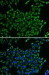 Immunofluorescence analysis of U2OS cells using Anti-MRPS30 Antibody (A11887). DAPI was used to stain the cell nuclei (blue)