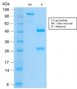 SDS-PAGE analysis of Anti-Integrin beta 3 Antibody [ITGB3/2166R] under non-reduced and reduced conditions; showing intact IgG and intact heavy and light chains, respectively. SDS-PAGE analysis confirms the integrity and purity of the Antibody