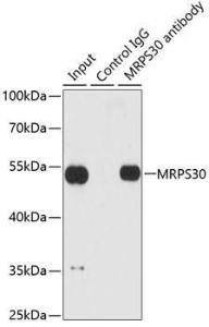 Immunoprecipitation analysis of 200 µg extracts of HepG2 cells using 1 µg of Anti-MRPS30 Antibody (A11887). This Western blot was performed on the immunoprecipitate using Anti-MRPS30 Antibody (A11887) at a dilution of 1:1000