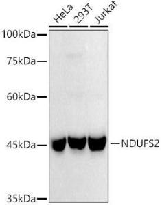 Anti-NDUFS2 Rabbit Monoclonal Antibody [clone: ARC3018]