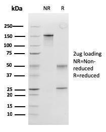 SDS-PAGE analysis of Anti-Calponin 1 Antibody [SPM169] under non-reduced and reduced conditions; showing intact IgG and intact heavy and light chains, respectively. SDS-PAGE analysis confirms the integrity and purity of the antibody.