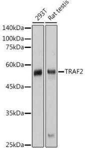 Western blot analysis of extracts of various cell lines, using Anti-TRAF2 Antibody (A305566) at 1:1,000 dilution. The secondary antibody was Goat Anti-Rabbit IgG H&L Antibody (HRP) at 1:10,000 dilution.