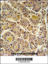 Anti-IN80D Rabbit Polyclonal Antibody