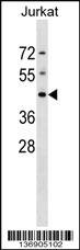 Anti-DHPS Rabbit Polyclonal Antibody