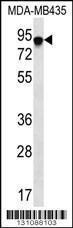 Anti-FYB Rabbit Polyclonal Antibody