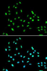 Immunofluorescence analysis of A549 cells using Anti-SMARCAD1 Antibody (A11888). DAPI was used to stain the cell nuclei (blue)