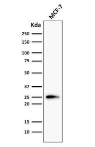 Western blot analysis of MCF-7 cell lysate using Anti-Bcl-2 Antibody [124]