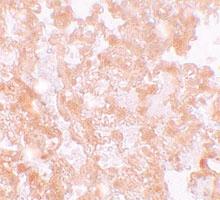 Anti-MFSD2A Rabbit Polyclonal Antibody