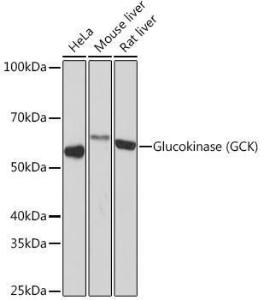 Western blot analysis of extracts of various cell lines, using Anti-Glucokinase Antibody [ARC1226] (A306563) at 1:1,000 dilution The secondary antibody was Goat Anti-Rabbit IgG H&L Antibody (HRP) at 1:10,000 dilution Lysates/proteins were present at 25 µg per lane