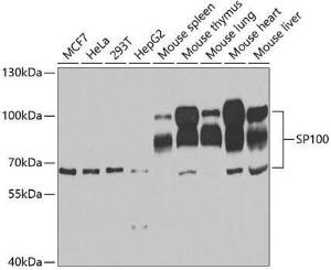 Western blot analysis of extracts of various cell lines, using Anti-SP100 Antibody (A11889) at 1:1,000 dilution