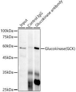 Immunoprecipitation analysis of 300 µg extracts of HeLa cells using 3 µg of Anti-Glucokinase Antibody [ARC1226] (A306563) This Western blot was performed on the immunoprecipitate using Anti-Glucokinase Antibody [ARC1226] (A306563) at a dilution of 1:1000