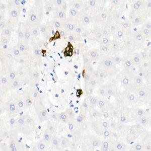 Immunohistochemistry analysis of paraffin-embedded human liver (negative control sample) using Anti-Cytokeratin 19 Antibody [ARC2811] (A307943) at a dilution of 1:20 (40x lens) Perform high pressure antigen retrieval with 10 mM citrate buffer pH 60 before commencing with IHC staining protocol