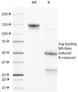 SDS-PAGE analysis of Anti-Bcl-2 Antibody [124] under non-reduced and reduced conditions; showing intact IgG and intact heavy and light chains, respectively. SDS-PAGE analysis confirms the integrity and purity of the antibody.