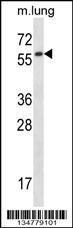 Anti-FYN Rabbit Polyclonal Antibody (Biotin)