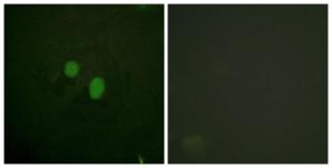 Immunofluorescence analysis of HeLa cells using Anti-HMG17 Antibody The right hand panel represents a negative control, where the antibody was pre-incubated with the immunising peptide