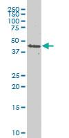 Anti-PDK2 Mouse Monoclonal Antibody [clone: 5F8]