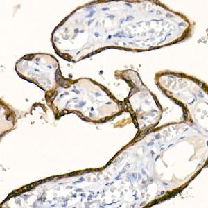 Immunohistochemistry analysis of paraffin-embedded human placenta using Anti-Cytokeratin 19 Antibody [ARC2811] (A307943) at a dilution of 1:20 (40x lens) Perform high pressure antigen retrieval with 10 mM citrate buffer pH 60 before commencing with IHC staining protocol