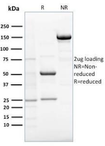 SDS-PAGE analysis of Anti-RCAS1 Antibody [CPTC-EBAG9-1] under non-reduced and reduced conditions; showing intact IgG and intact heavy and light chains, respectively. SDS-PAGE analysis confirms the integrity and purity of the antibody