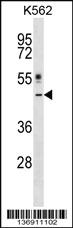 Anti-CRLF1 Rabbit Polyclonal Antibody