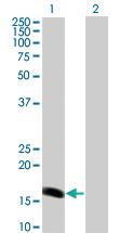 Anti-BARX1 Mouse Monoclonal Antibody [clone: 1E7]