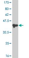 Anti-PMS1 Mouse Monoclonal Antibody [clone: 2G10]