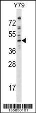 Anti-DMTN Rabbit Polyclonal Antibody (Biotin)