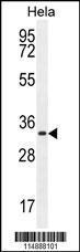 Anti-CCNH Rabbit Polyclonal Antibody (AP (Alkaline Phosphatase))