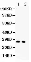 Anti-P27 KIP 1 Polyclonal Antibody